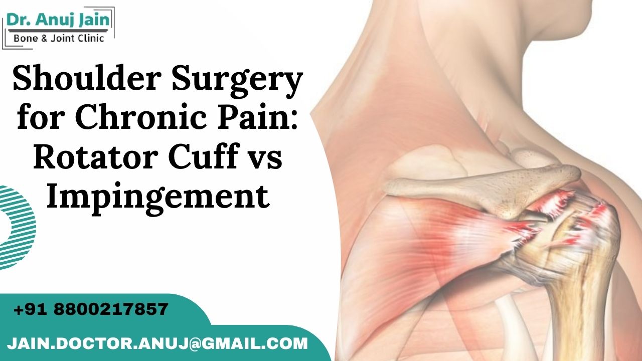 Shoulder Surgery for Chronic Pain
